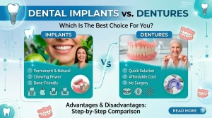 Dental Implants vs. Dentures