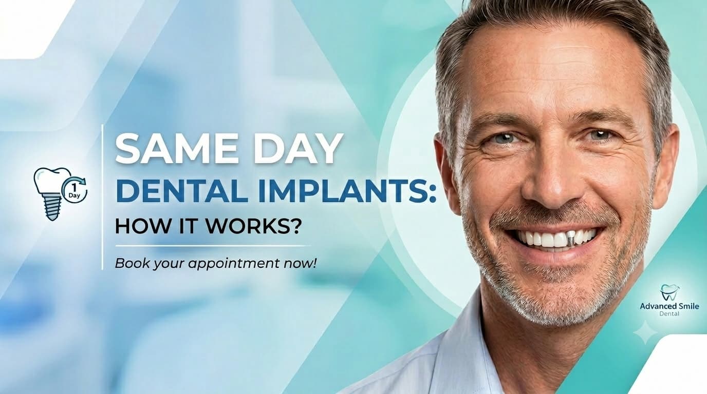 Same Day Dental Implants: How It Works?
